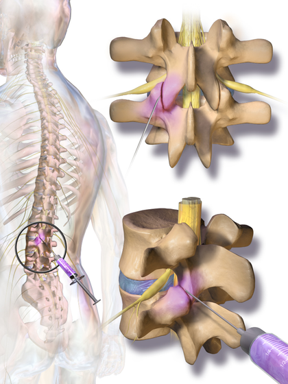 Person holding their lower back